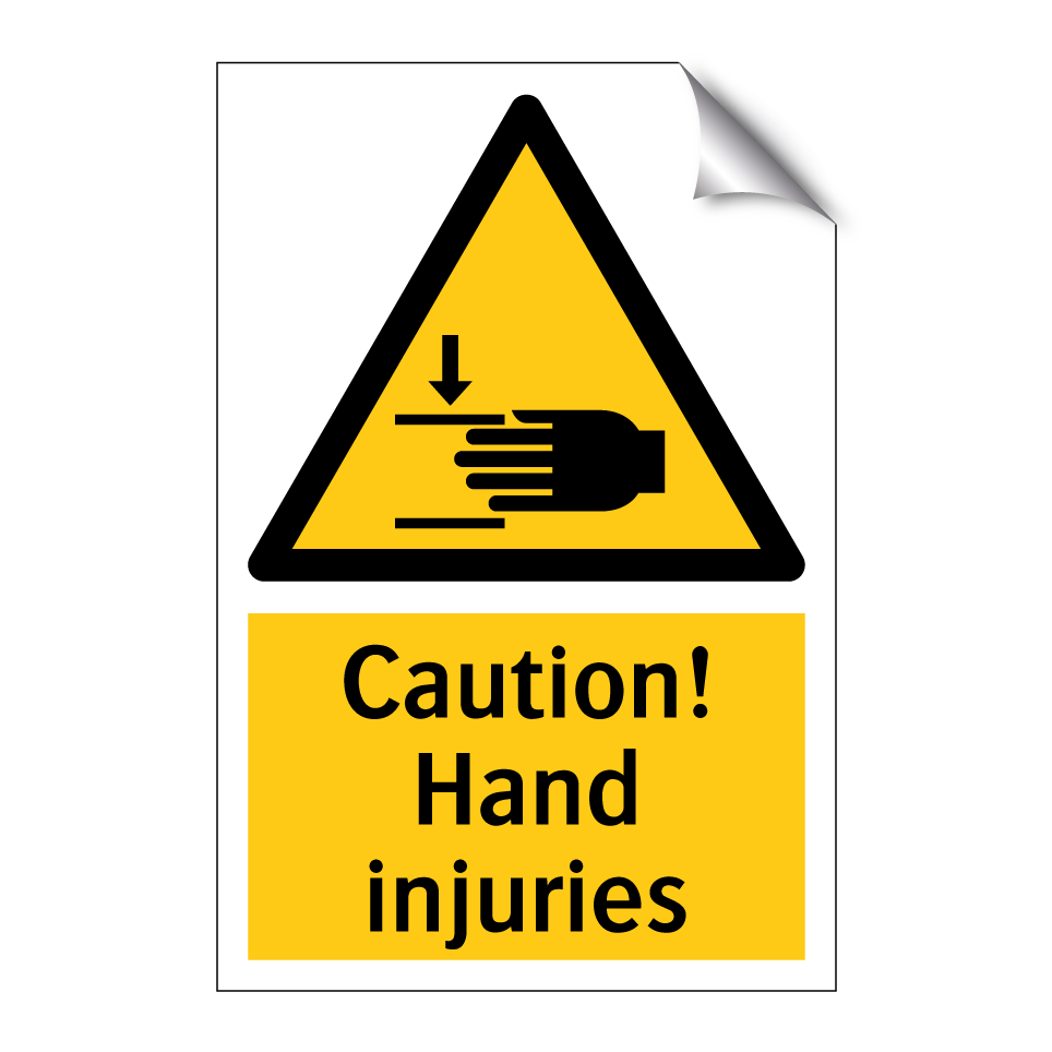 Caution! Hand injuries