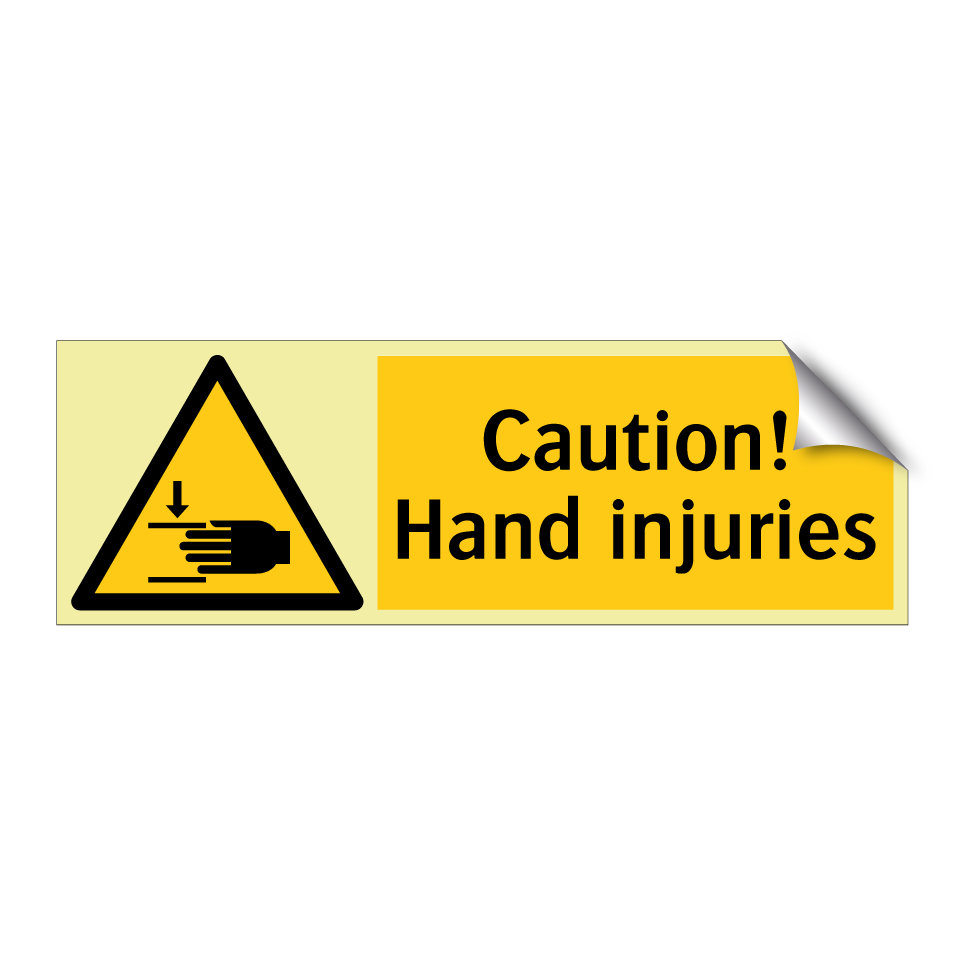 Caution! Hand injuries