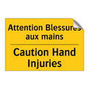 Attention Blessures aux mains - Caution Hand Injuries